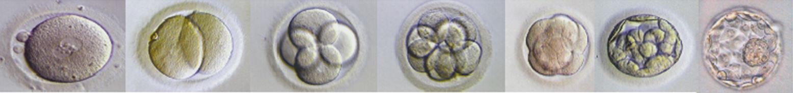 Figura ilustrativa todas as etapas do desenvolvimento embrionário in vitro: de zigoto a blastocisto