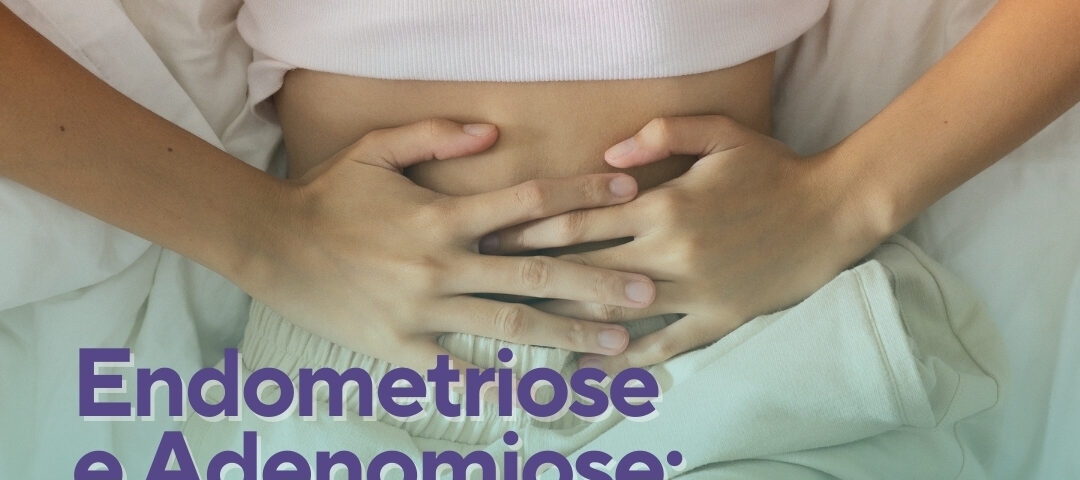 Endometriose E Adenomiose Qual A Diferen A Nidus Medicina Reprodutiva